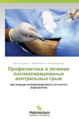 Kniha Profilaktika I Lechenie Posleoperatsionnykh Ventral'nykh Gryzh Valuyskaya Nelli