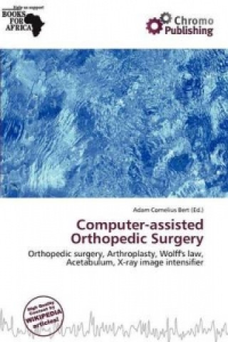 Knjiga Computer-Assisted Orthopedic Surgery 