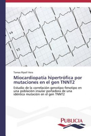 Carte Miocardiopatia hipertrofica por mutaciones en el gen TNNT2 Ripoll Vera Tomas