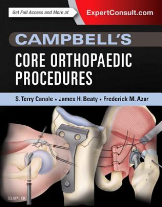 Carte Campbell's Core Orthopaedic Procedures S. Terry Canale