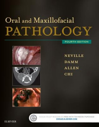 Kniha Oral and Maxillofacial Pathology Angela C. Chi