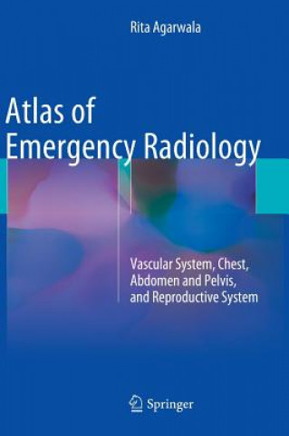 Kniha Atlas of Emergency Radiology Rita Agarwala