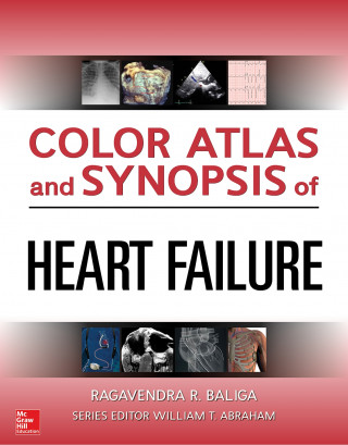 Könyv Color Atlas and Synopsis of Heart Failure Garrie Haas