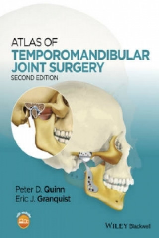 Könyv Atlas of Temporomandibular Joint Surgery, 2e Peter Quinn