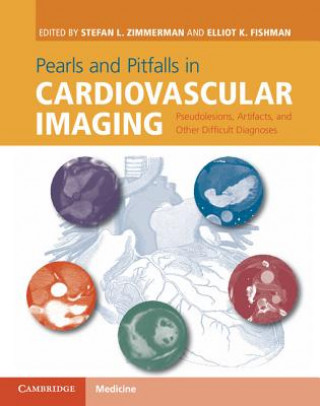 Book Pearls and Pitfalls in Cardiovascular Imaging Stefan L. Zimmerman