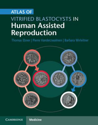 Könyv Atlas of Vitrified Blastocysts in Human Assisted Reproduction Thomas Ebner