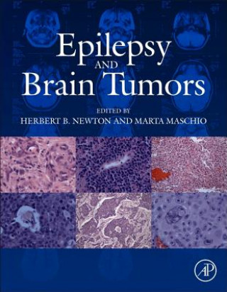 Książka Epilepsy and Brain Tumors Herbert B Newton