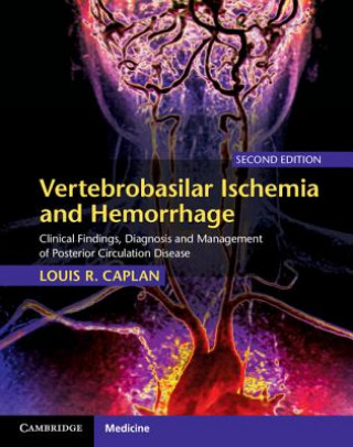 Könyv Vertebrobasilar Ischemia and Hemorrhage Louis R. Caplan