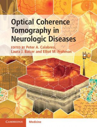 Kniha Optical Coherence Tomography in Neurologic Diseases Peter A. Calabresi