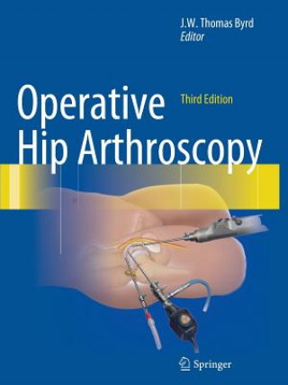 Könyv Operative Hip Arthroscopy J. W. Thomas Byrd