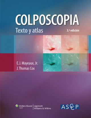 Kniha Colposcopia. Texto y atlas American Society for Colposcopy and Cervical Pathology