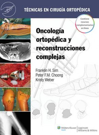 Kniha Tecnicas en cirugia ortopedica. Oncologia ortopedica y reconstrucciones complejas Franklin H. Sim