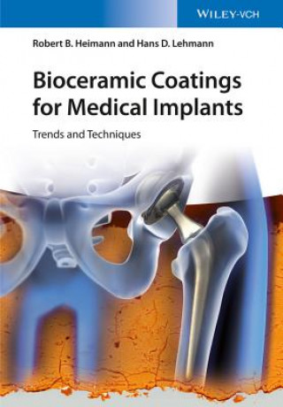 Kniha Bioceramic Coatings for Medical Implants - Trends and Techniques Robert B. Heimann