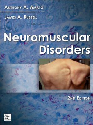 Książka Neuromuscular Disorders James A. Russell