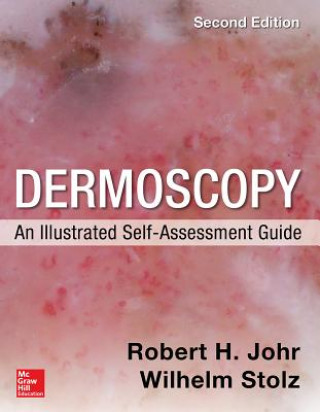 Könyv Dermoscopy: An Illustrated Self-Assessment Guide, 2/e Wilhelm Stolz