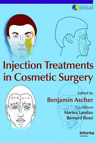 Knjiga Injection Treatments in Cosmetic Surgery 