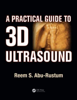 Carte Practical Guide to 3D Ultrasound Reem S. Abu-Rustum