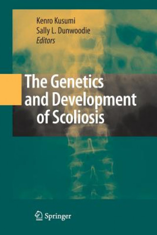 Kniha Genetics and Development of Scoliosis Sally L. Dunwoodie
