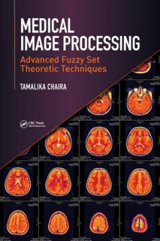 Knjiga Medical Image Processing TAMALIKA CHAIRA