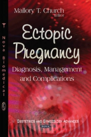 Книга Ectopic Pregnancy Mallory T Church