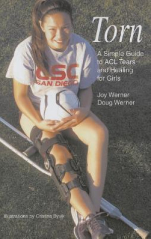 Buch Torn Doug Werner
