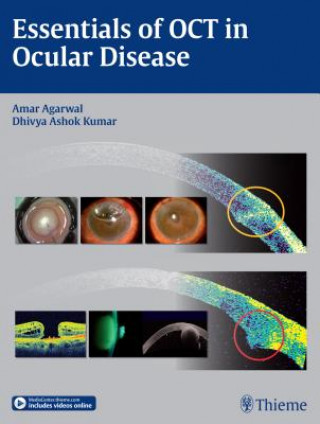 Knjiga Essentials of OCT in Ocular Disease Amar Agarwal