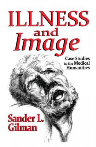 Kniha Illness and Image Sander L. Gilman
