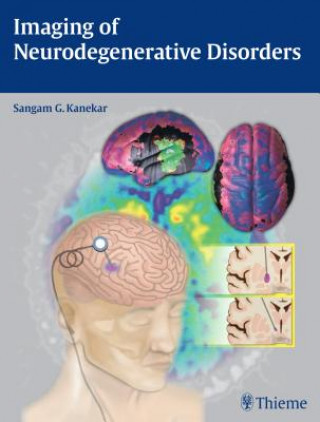 Kniha Imaging of Neurodegenerative Disorders Sangam Kanekar