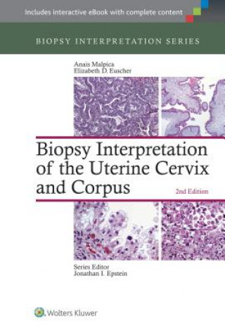 Könyv Biopsy Interpretation of the Uterine Cervix and Corpus Anais Malpica