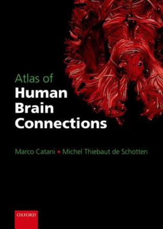 Kniha Atlas of Human Brain Connections Marco Catani