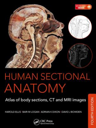 Книга Human Sectional Anatomy Adrian K Dixon