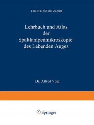 Carte Lehrbuch Und Atlas Der Spaltlampenmikroskopie Des Lebenden Auges A Vogt