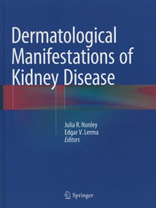 Könyv Dermatological Manifestations of Kidney Disease Julia Nunley