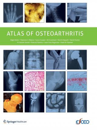 Könyv Atlas of Osteoarthritis Nigel Arden
