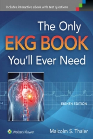 Only Ekg Book You'll Ever Need | Libristo - Magyarország