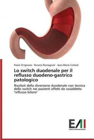 Book Lo switch duodenale per il reflusso duodeno-gastrico patologico Strignano Paolo