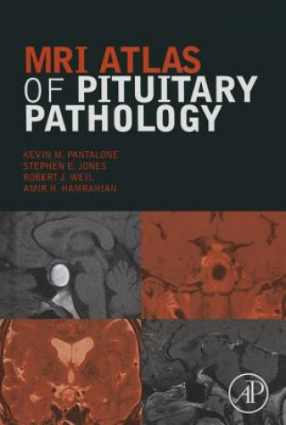Könyv MRI Atlas of Pituitary Pathology Amir H. Hamrahian