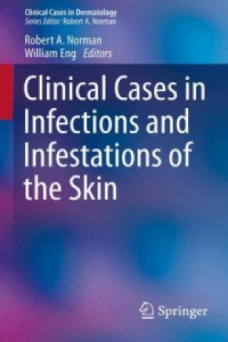 Kniha Clinical Cases in Infections and Infestations of the Skin Robert A. Norman