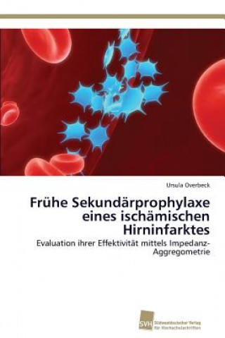 Kniha Fruhe Sekundarprophylaxe eines ischamischen Hirninfarktes Overbeck Ursula