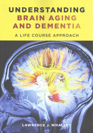 Kniha Understanding Brain Aging and Dementia Lawrence J. Whalley
