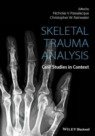 Knjiga Skeletal Trauma Analysis - Case Studies in Context Passalacqua