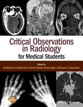 Carte Critical Observations in Radiology for Medical Students Kiran Riddy Busireddy