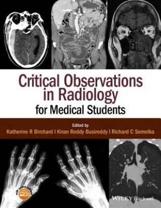 Kniha Critical Observations in Radiology for Medical Students Kiran Riddy Busireddy