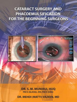 Knjiga Cataract Surgery And Phacoemulsification For The Beginning Surgeons Dr S M Munirul Huq