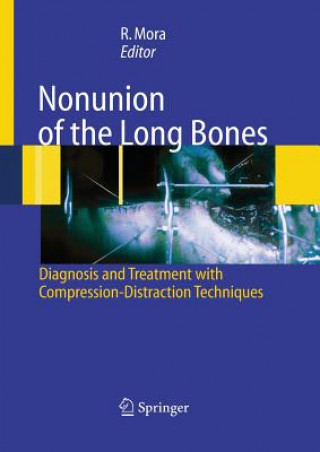 Carte Nonunion of the Long Bones Redento Mora