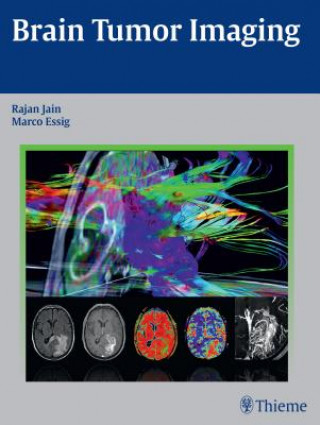 Könyv Brain Tumor Imaging Rajan Jain