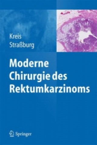 Carte Moderne Chirurgie des Rektumkarzinoms Martin E. Kreis