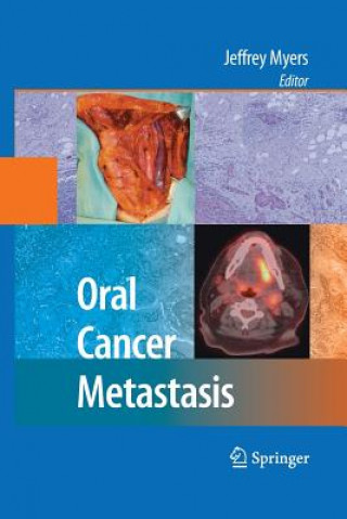 Kniha Oral Cancer Metastasis Jeffrey Myers