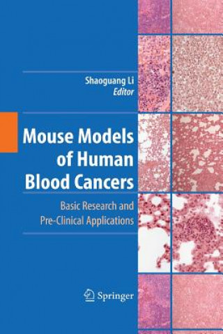 Carte Mouse Models of Human Blood Cancers Shaoguang Li