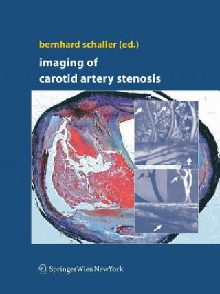 Kniha Imaging of Carotid Artery Stenosis Bernhard Schaller
